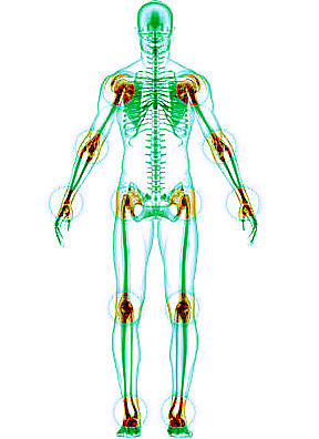 Reference Pricing for Arthroscopy Reference Pricing for Arthroscopy